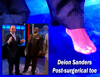Deion Sanders Toe 2